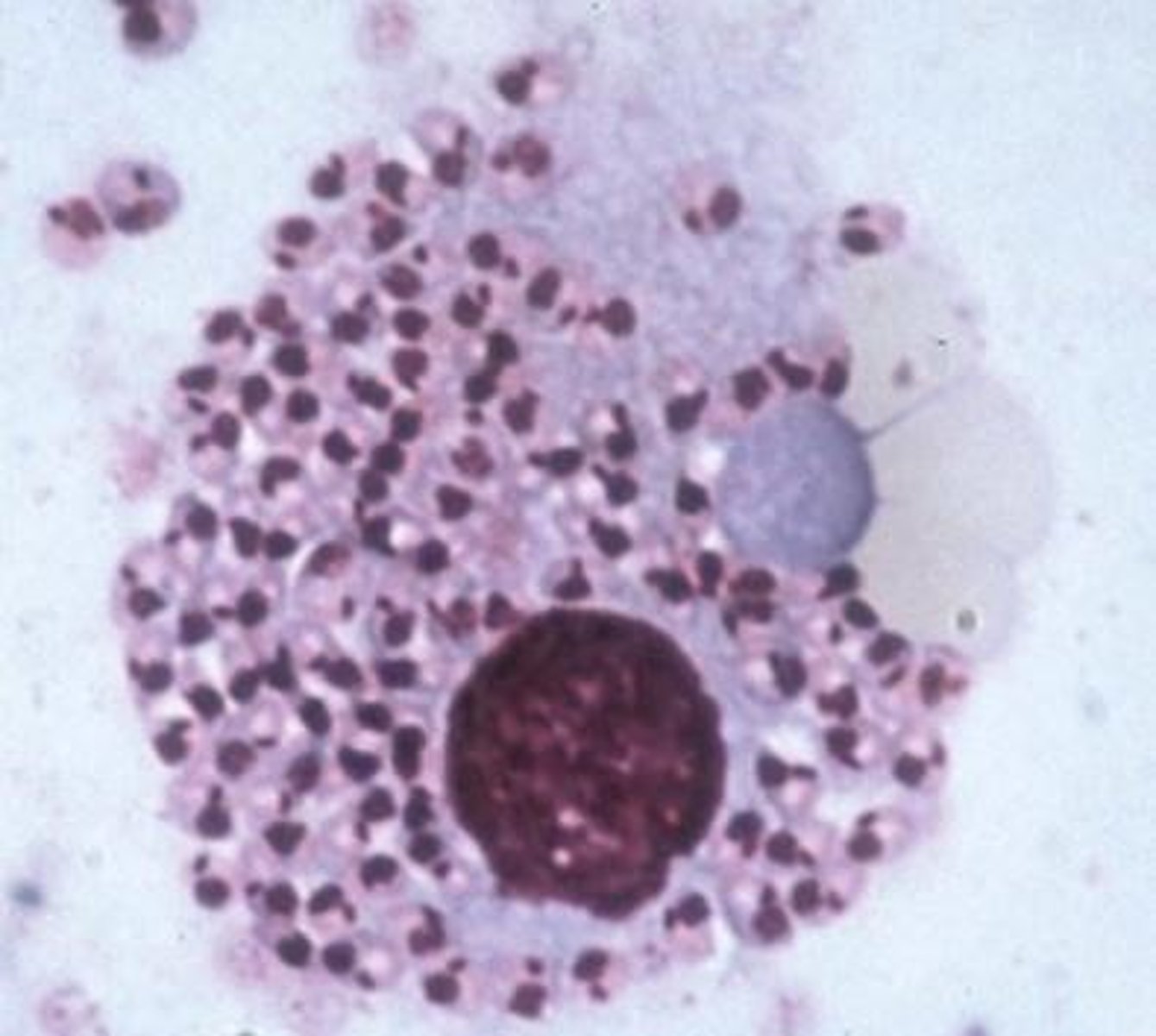 <p>Identify the nest of organisms seen in the macrophage from the bone marrow aspirate taken from a dog showing polydipsia, polyuria, and generalized dermatological disease. The owner and his pet recently moved to Lee County after 10 years residence in Greece.</p>