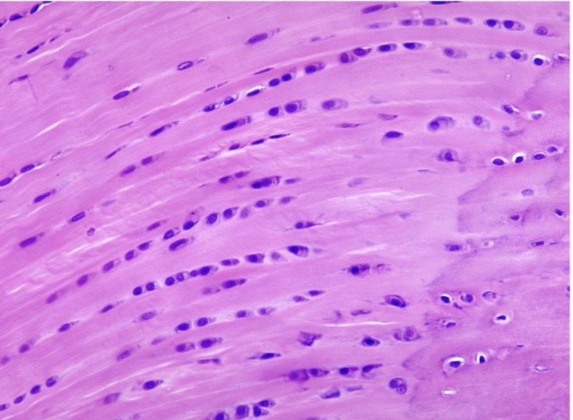 <p>what type?</p>