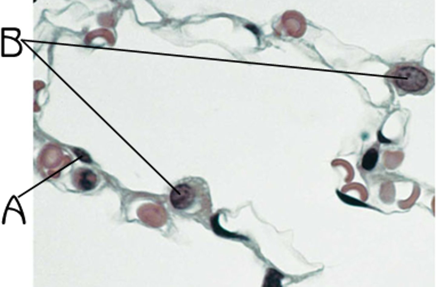 <p>A</p>