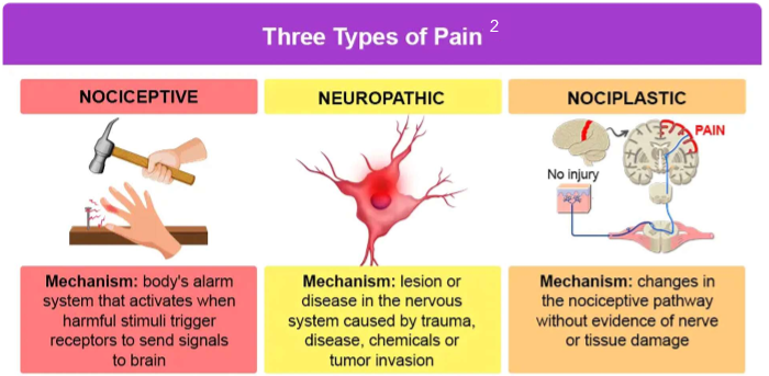 <ul><li><p>nociceptive</p><ul><li><p>most common type of pain</p></li><li><p>pain due to actual or threatened damage to non-neural tissue activating nociceptors</p></li><li><p>adaptive</p></li><li><p>2 subtypes (somatic, visceral)</p></li></ul></li><li><p>neuropathic</p><ul><li><p><strong>pain due to lesion or disease affecting the somatosensory system</strong></p></li><li><p><strong>damage to peripheral or central nerves</strong></p></li><li><p>often chronic</p></li><li><p>maladaptive</p></li></ul></li><li><p>nociplastic</p><ul><li><p><strong>idiopathic pain that has no clear evidence of tissue damage or damage to the somatosensory system</strong></p></li><li><p><strong>fibromyalgia</strong></p></li><li><p>IBS</p></li></ul></li><li><p>mixed</p><ul><li><p>overlap of nociceptive and neuropathic sx</p></li><li><p>ex: cancer, OA</p></li></ul></li></ul><p></p>