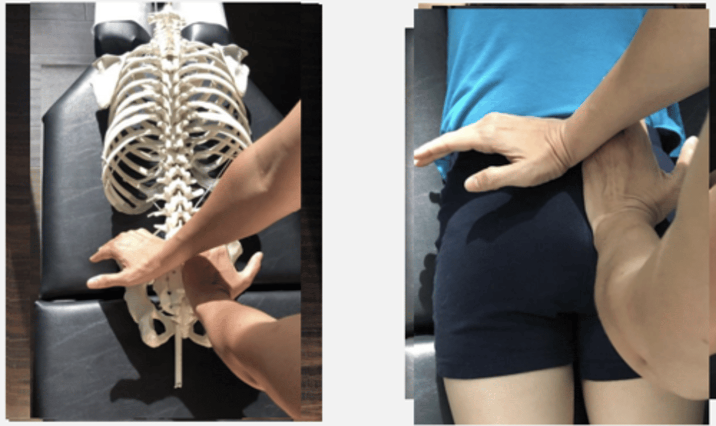 <p>PP: Prone-verbalize how you found the segment</p><p>DP: Square or Modified fencer stance on side opposite the dysfunction</p><p>CH: Cephalad (R) hand, hypothenar (pisiform) on L PSIS</p><p>IH: Caudal (L) hand knife-edge on side of sacral apex closest to you</p><p>LOD: CH: P-A, M-L, slight I-S</p><p>IH: P-A, slight S-I</p>