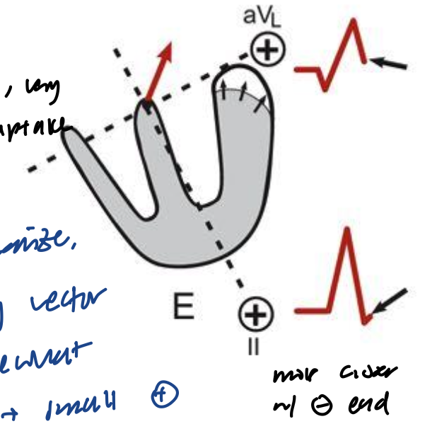 <p><strong>The Electrocardiogram</strong></p><p>What is happening here?</p>