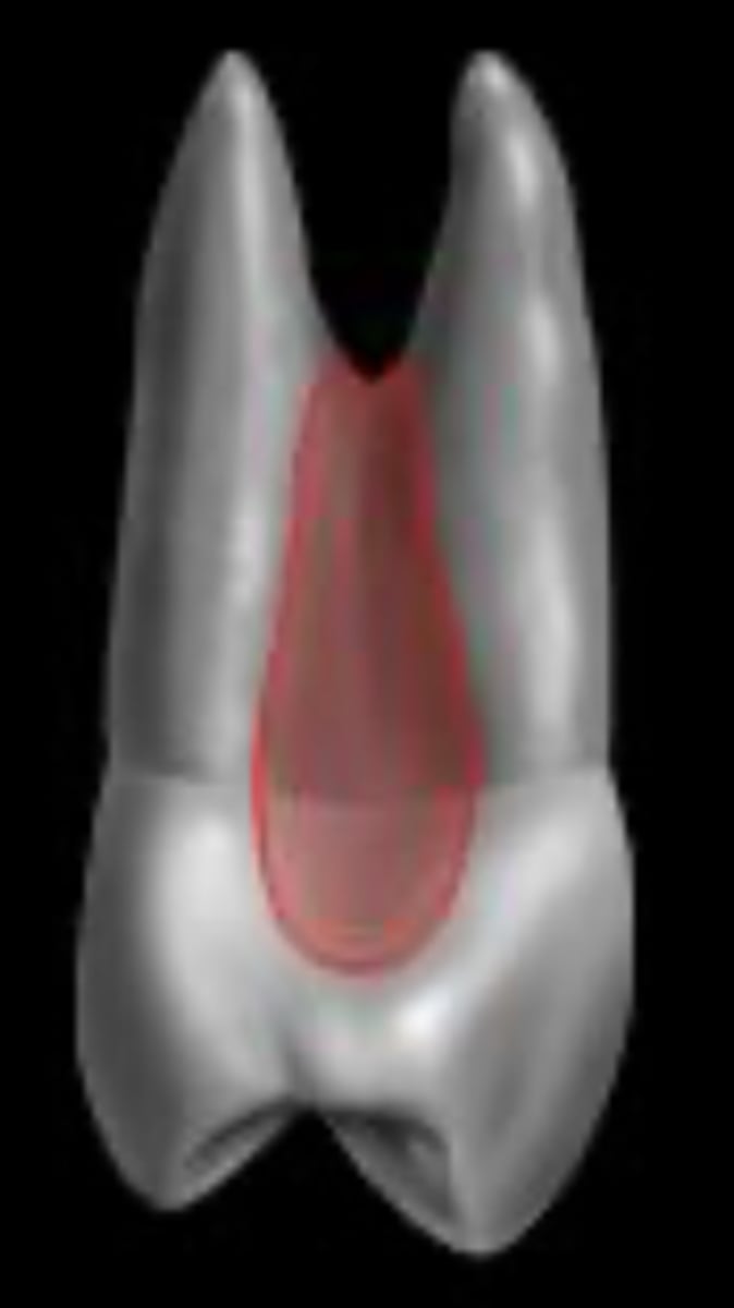 <p>developmental root depression</p><p>(picture is from mesial view, not buccal)</p>