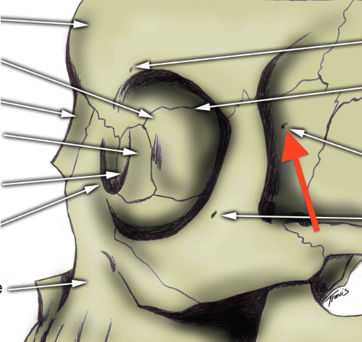 <p>on zygomatic bone temporal side</p>