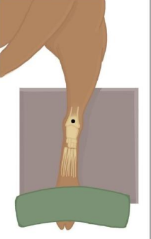<p>Sternal recumbency with affected limb extended caudally onto xray plate</p><p>Secure distal limb with rope tie (either view) or sandbag over phalanges (tarsal view only) </p><p>Remove overlying structures, ensure tail &amp; any positioning aids not in primary beam </p>