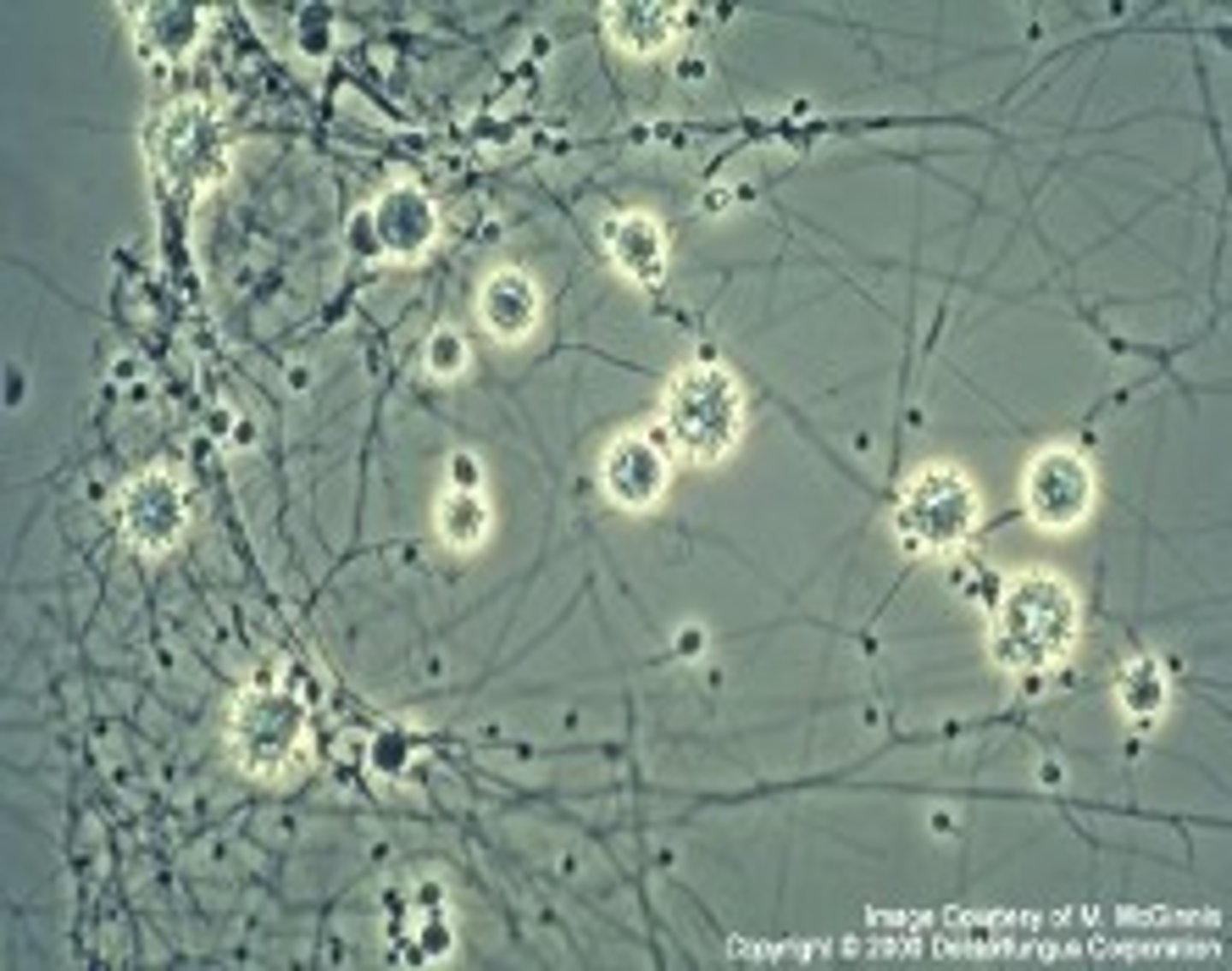 <p>(Mold form)</p>