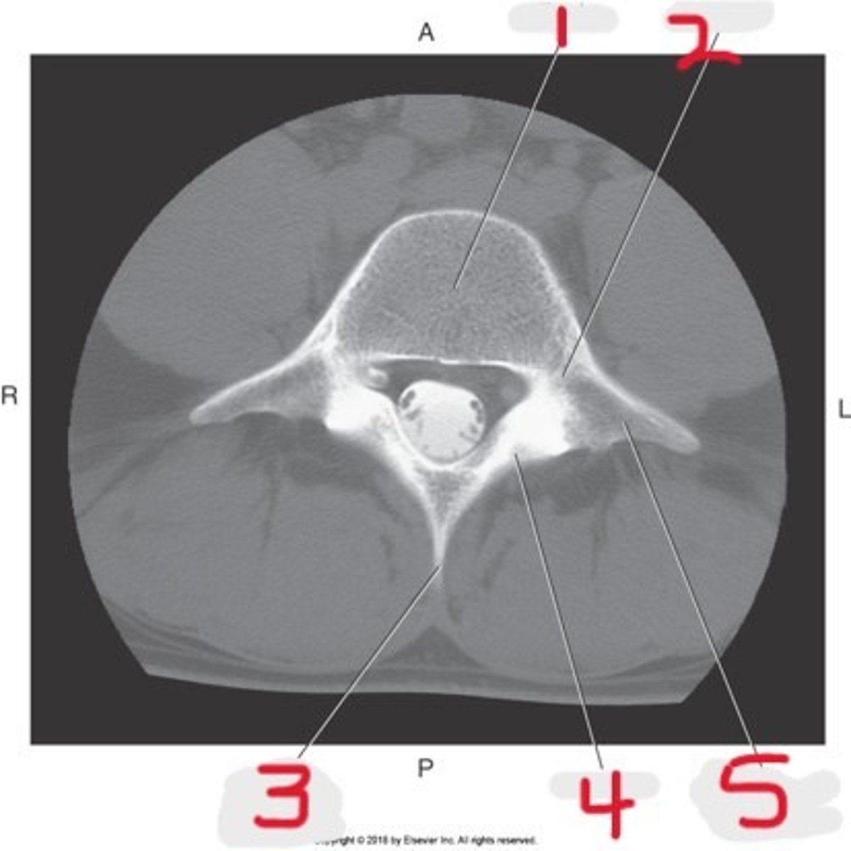 <p>Name all numbered structures</p>
