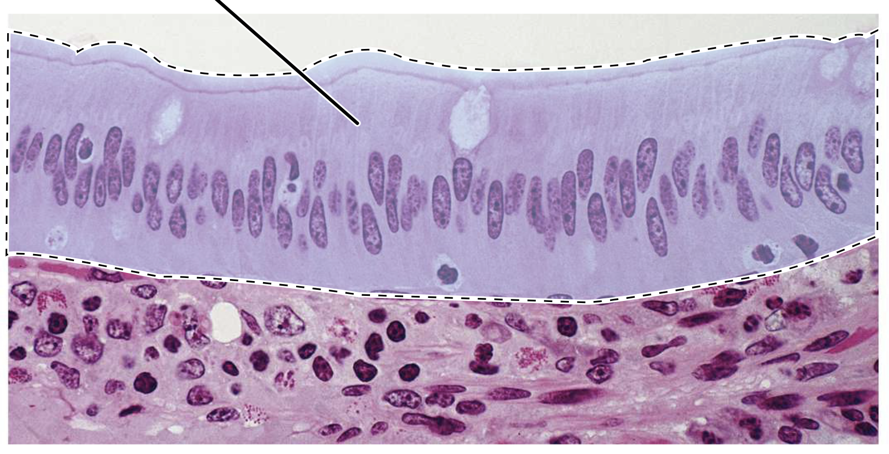 <p>Name the highlighted tissue.</p>