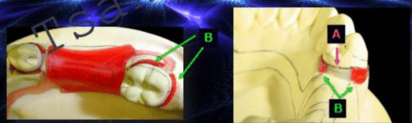 <p>ID the type of block out at B</p>