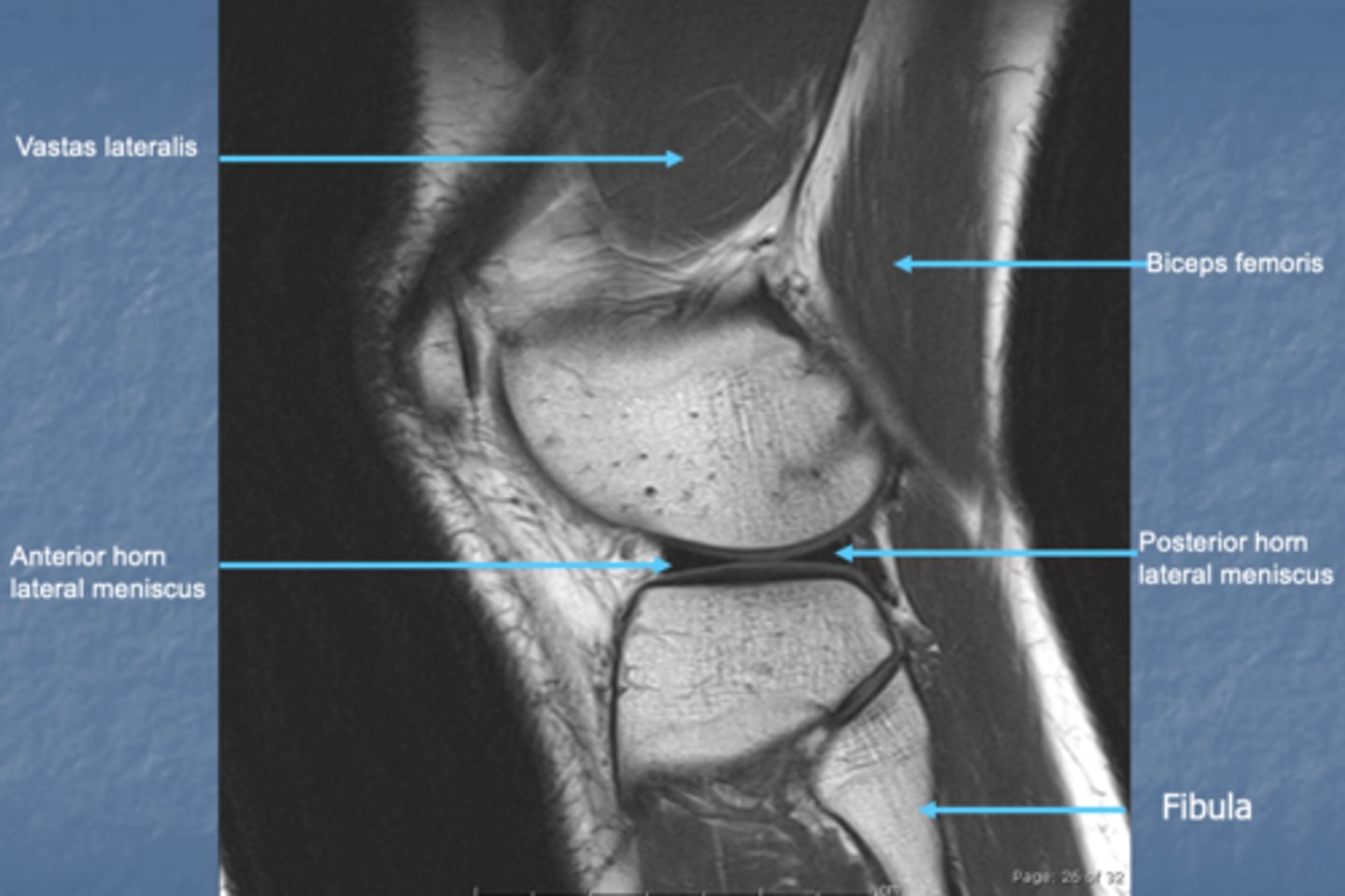 <p>looks like lateral radiograph</p>