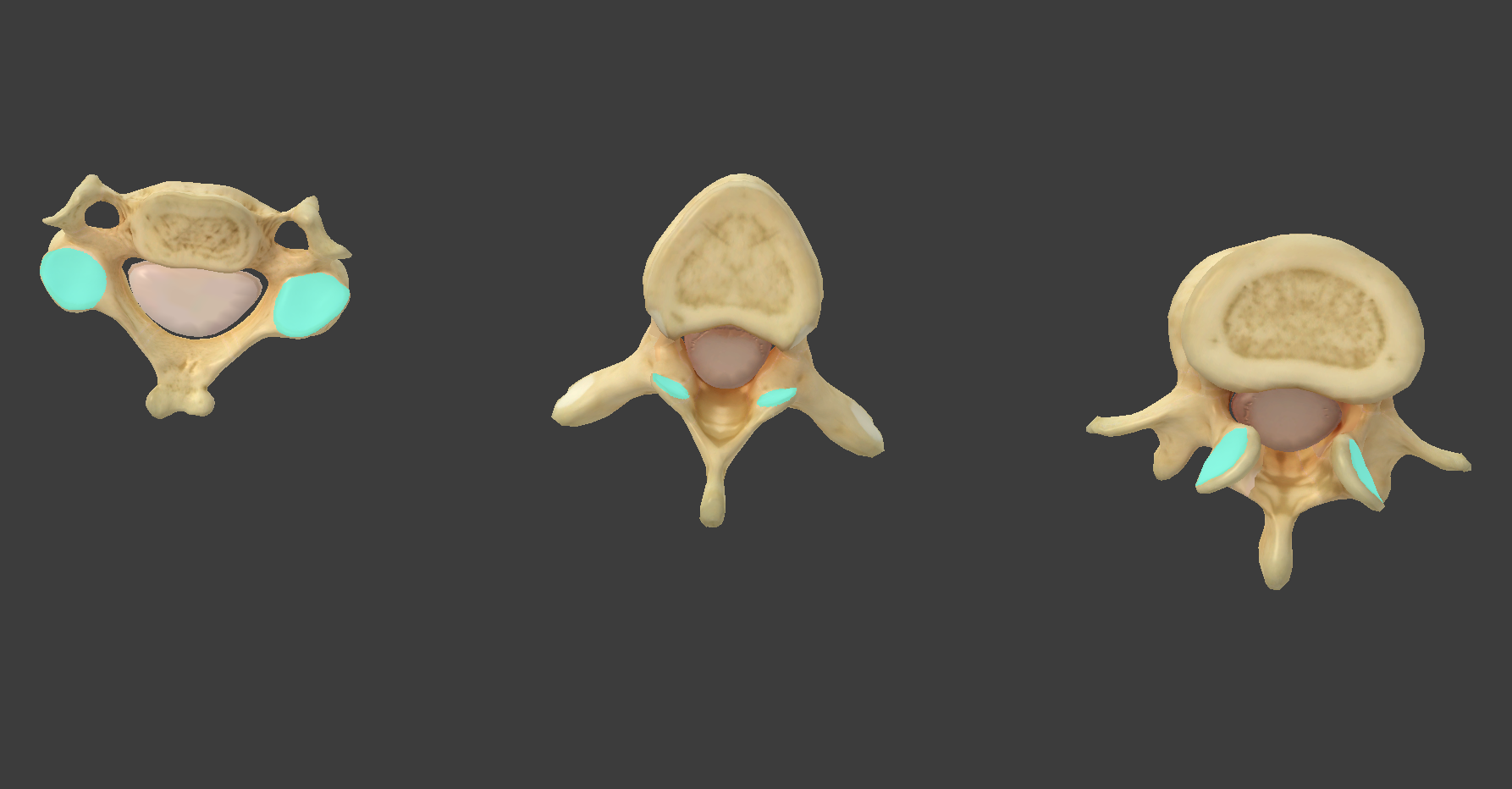 <p>what component of vertebrae is this?</p>