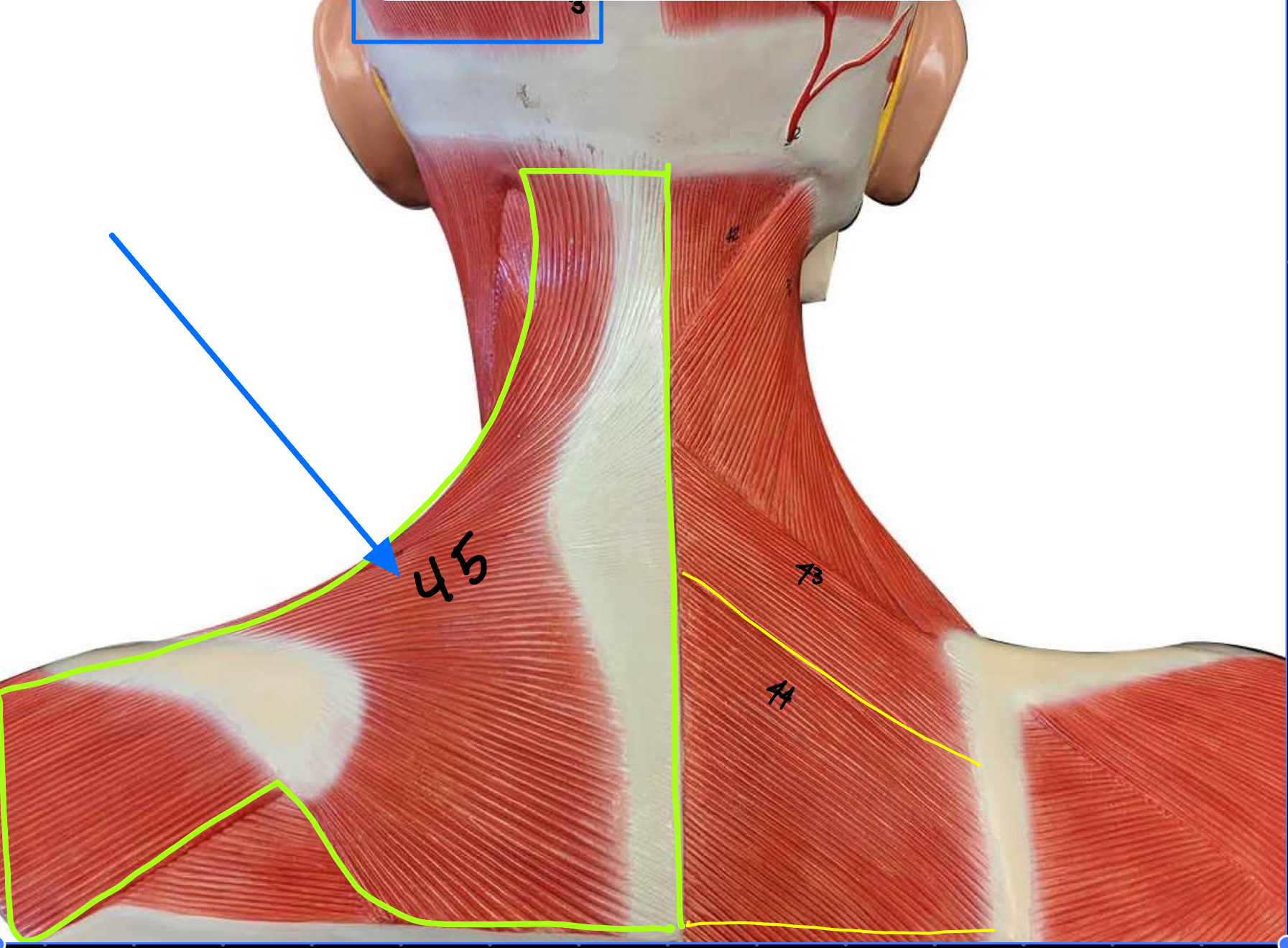 <p>What type of muscle is this ( altay model)</p>