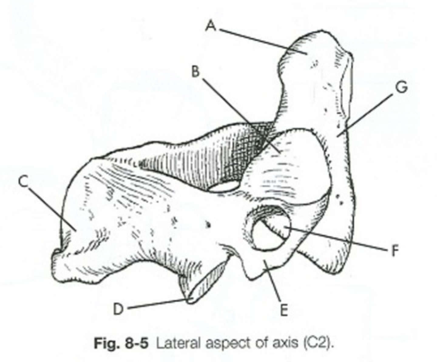 <p>What is letter G?</p><p>spinous process</p><p>lamina</p><p>body</p><p>dens</p>