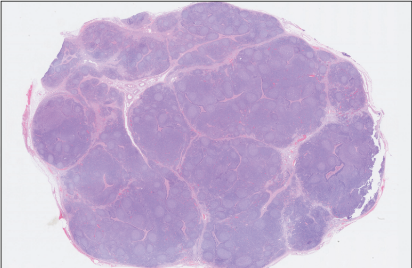 <p>What animal does this lymph node belong to?</p>