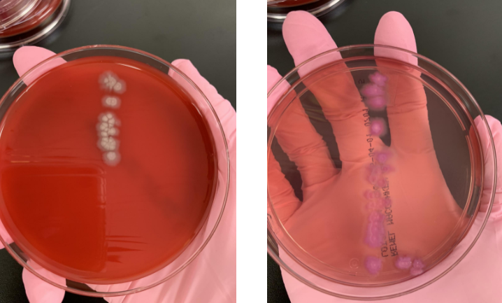<p>is this a UTI</p>