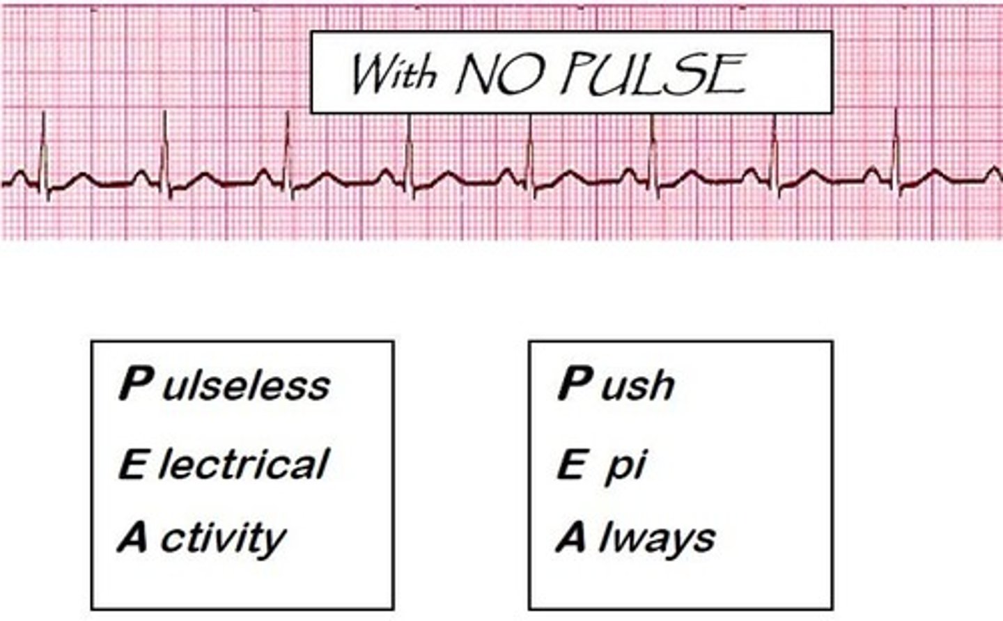 <p>Minimal electrical activity with NO PULSE, often bradycardic.</p><p>Commonly the initial arrest rhythm.</p><p>Assess the H's and T's Hypovolemia, Hypoxia, hydrogen ions (acidosis), hyper/hypokalemia, hypoglycemia, and hypothermia. T's- Toxins, Tampanode, Tension pneumothorax, Thrombosis, and Trauma.</p><p>Initiate CPR, epinephrine, ACLS algorithm.</p><p>DO NOT SHOCK</p>