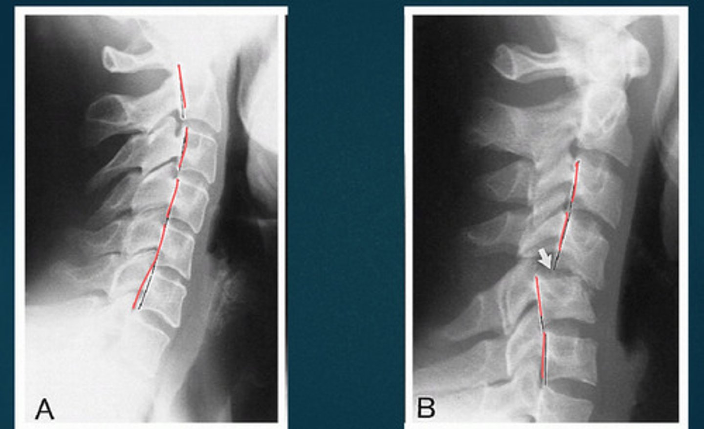 <p>What line of mensuration is this?</p>