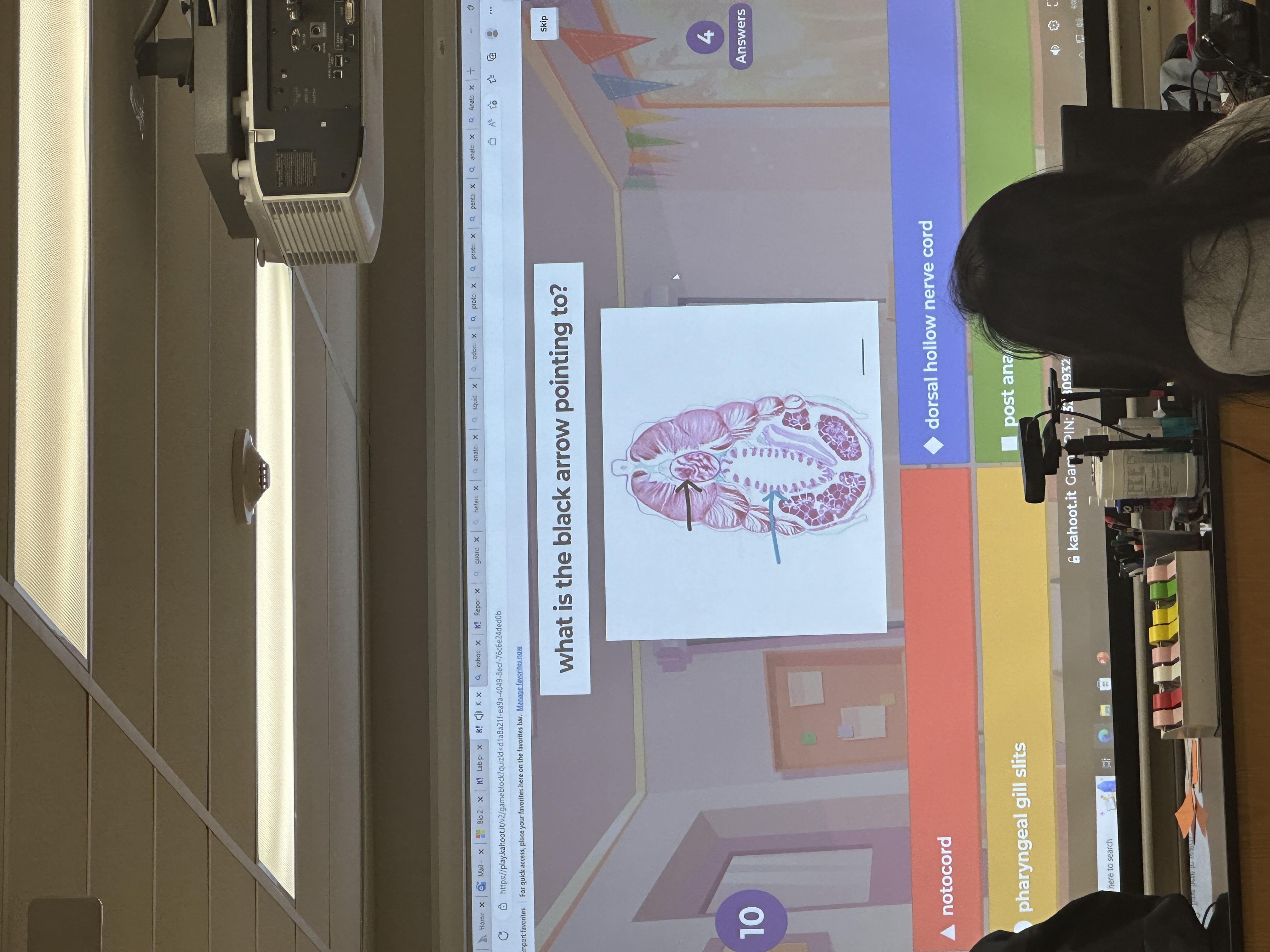 WHAT IS THE BLACK ARROW POINTING TO?