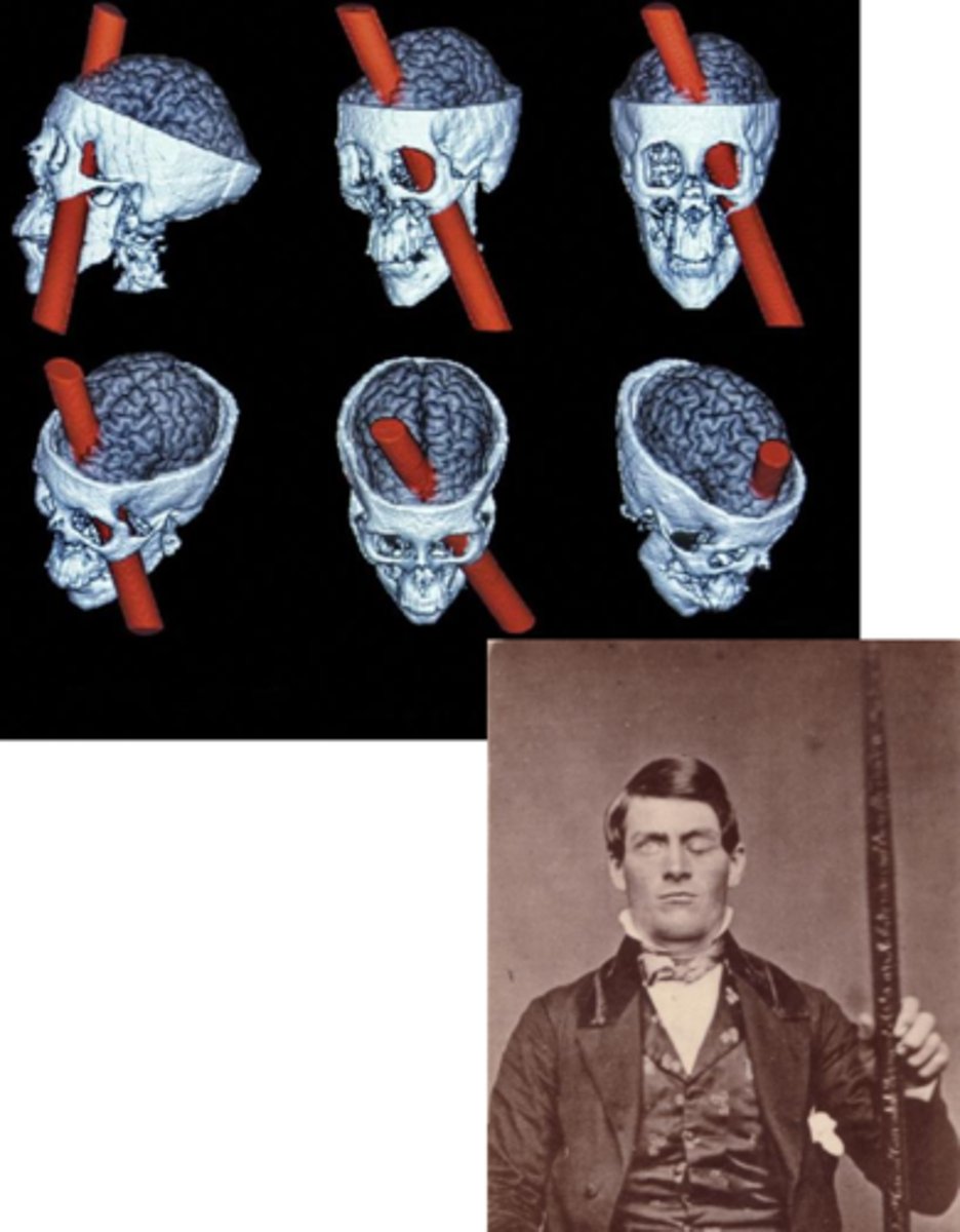 <p>- Most overdeveloped area relative to non-human species </p><p>- Responsible for executive functioning: manages planning, adaptability, selective attention, and working memory to organize, focus, and adjust behavior effectively </p><p></p><p><strong>Case Study Example: Phineas Gage</strong></p><p>- 1848 railroad accident, spike through prefrontal cortex</p><p>- Resulted in corresponding behavioural changes: self awareness, planning, initiative, responsibility, emotional reactivity changed: impulsive, irritable, and prone to inappropriate emotional outbursts, critically implicated in the frontal lobe </p><p></p><p><strong>Prefrontal Cortex:</strong></p><p>- Seat of executive functions</p><p>- Goal-setting, judgement, planning, adaptive behaviours: ability to control impulses: profound changes in personality </p>