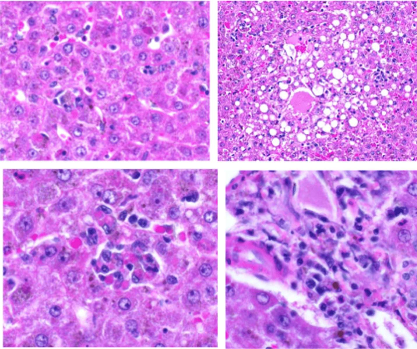 <p>d. Lymphocytic choriomeningitis virus. (Disease is Callitrichid hepatitis)</p>