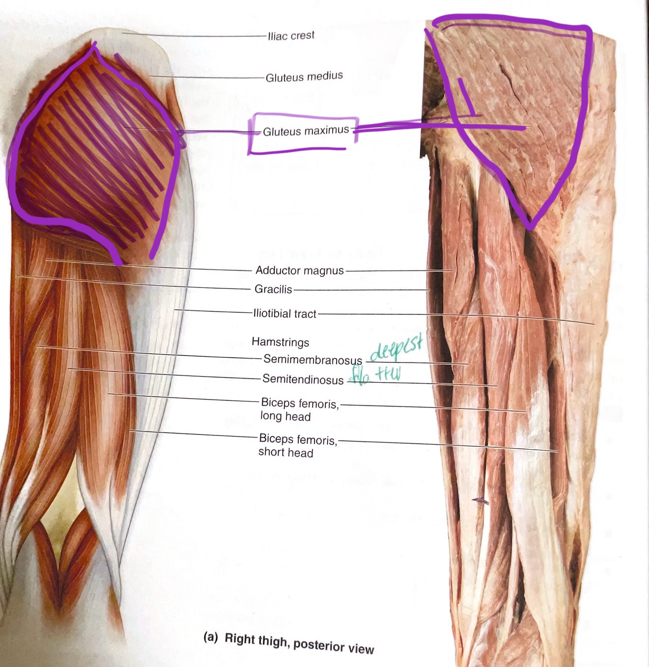 <p>Action:Extend, laterally rotates hip</p>