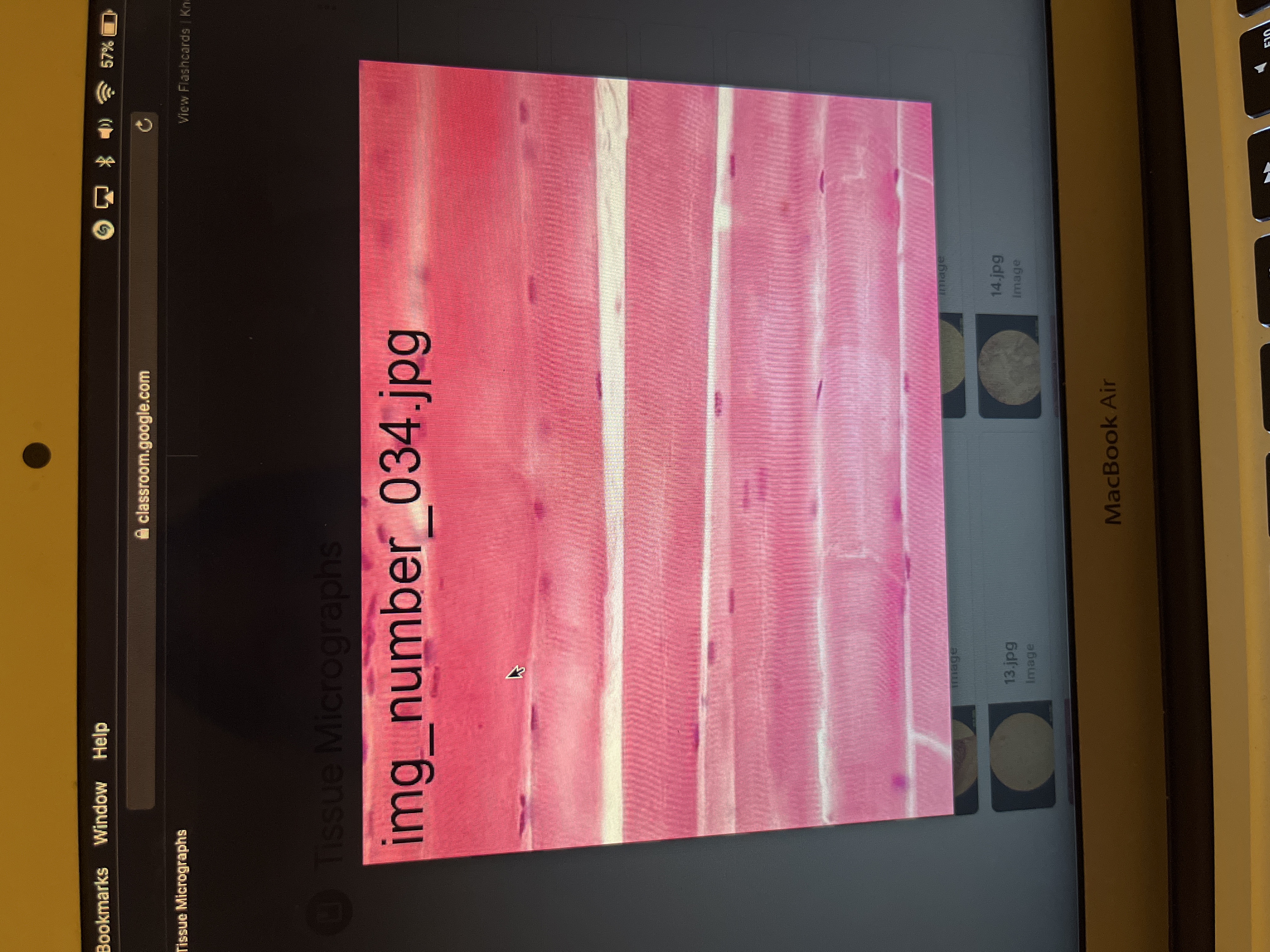 Location:attached to bone by tendons
Function: motion, posture, heat production, protection 