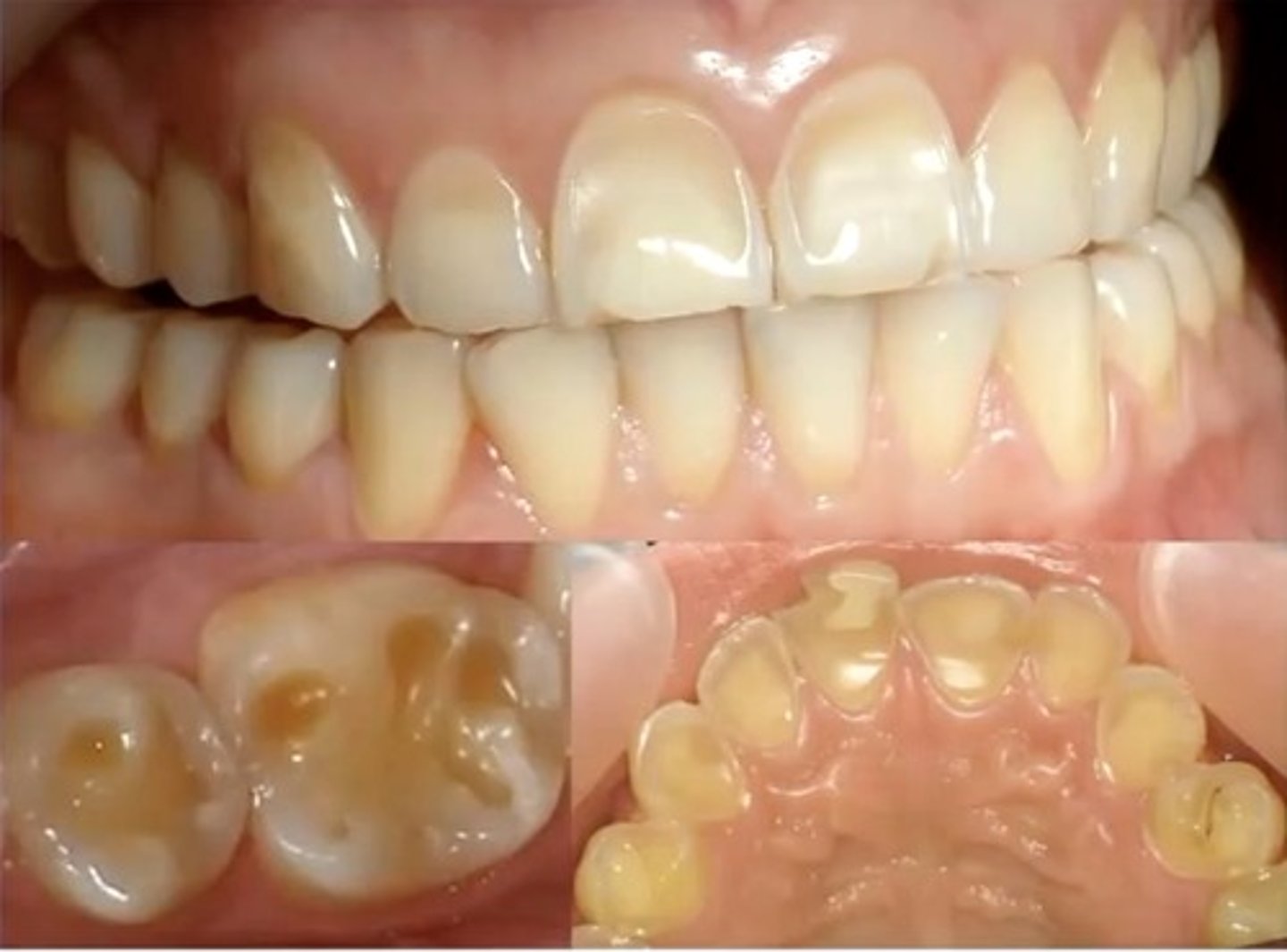 <p>identify the type of differential diagnosis</p>
