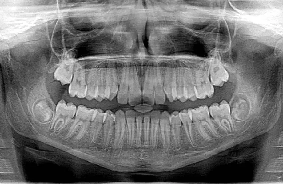 <p>A picture or representation of a dental structure produced by X-rays.</p>