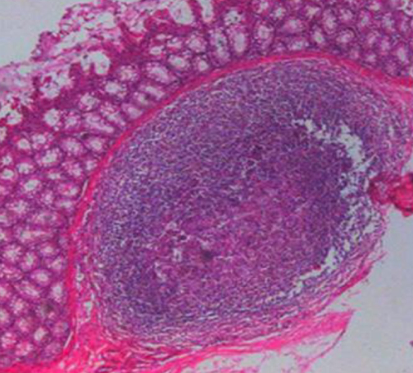 <p>What is the pathology?</p>
