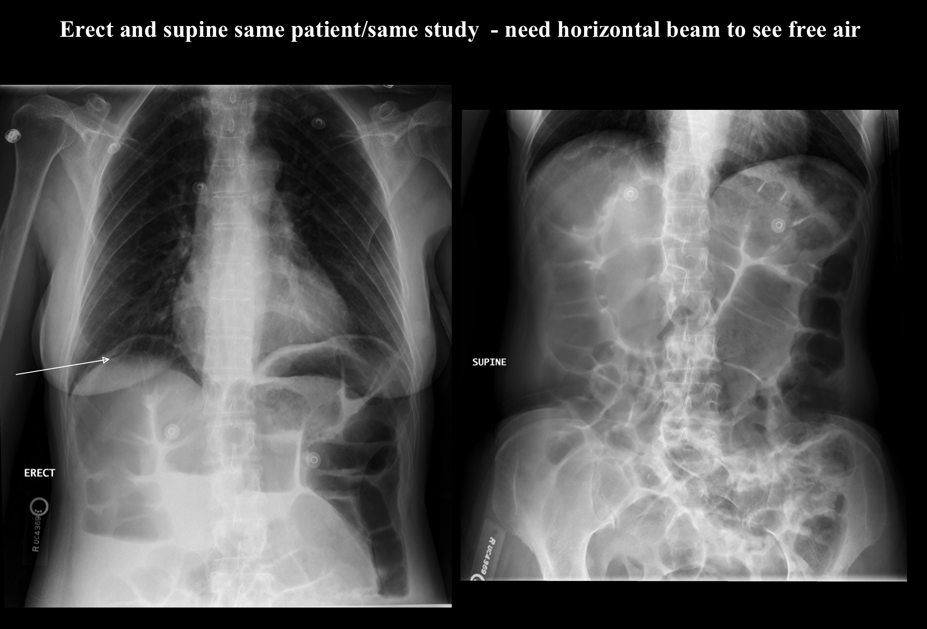 <p>What pathology is this?</p>