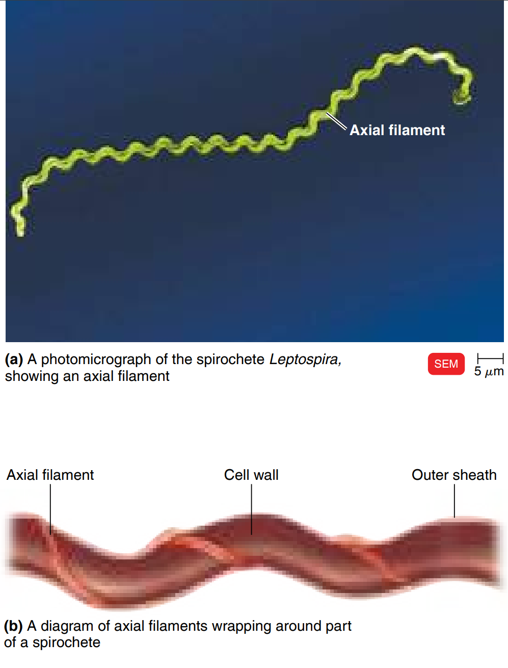 <ul><li><p>Also called endoflagella&nbsp;</p></li><li><p>Found in spirochetes&nbsp;</p></li><li><p>Anchored at one end of a cell</p></li><li><p>Propels the bacteria in a spiral motion</p></li><li><p><span style="background-color: transparent;">Found inside spirochetes, between cell wall and outer membrane.<br><br></span></p></li></ul><ul><li><p><span style="background-color: transparent;">Covered by sheath → <strong>protected</strong>.<br><br></span></p></li><li><p><span style="background-color: transparent;">Provides strong corkscrew movement.<br><br></span></p></li><li><p><span style="background-color: transparent;"><em>Side note</em>: Impossible to stain because of the protective covering.<br><br></span></p></li><li><p><span data-name="cyclone" data-type="emoji">🌀</span> <strong>Axial Filaments (Endoflagella)</strong> </p><ul><li><p>Found in <strong>spirochetes</strong> (a special group of spiral bacteria).</p></li><li><p>Examples:</p><ul><li><p><em>Treponema pallidum</em> → causes <strong>syphilis</strong>.</p></li><li><p><em>Borrelia burgdorferi</em> → causes <strong>Lyme disease</strong>.</p></li></ul></li></ul><p> </p><div data-type="horizontalRule"><hr></div><p> <span data-name="wrench" data-type="emoji">🔧</span> <strong>Structure</strong> </p><ul><li><p>Axial filaments are <strong>inside the cell wall</strong>, under the outer sheath.</p></li><li><p>They are bundles of tiny fibers (fibrils) anchored at each end.</p></li><li><p>They twist around the bacterium.</p></li></ul><p> </p><div data-type="horizontalRule"><hr></div><p> <span data-name="rocket" data-type="emoji">🚀</span> <strong>Movement</strong> </p><ul><li><p>When the axial filaments rotate → the <strong>whole bacterium twists</strong> like a <strong>corkscrew (spiral drill)</strong>.</p></li><li><p>This corkscrew motion helps spirochetes move through <strong>thick fluids</strong> (like mucus or tissue).</p></li></ul><p> </p><div data-type="horizontalRule"><hr></div><p> </p><p><span data-name="point_right" data-type="emoji">👉</span> <strong>Super simple:</strong></p><p> </p><ul><li><p>Flagella = outside tails (like a propeller).</p></li><li><p><strong>Axial filaments = hidden tails inside</strong> that make the bacteria <strong>twist like a corkscrew</strong>.</p></li><li><p>This helps diseases like syphilis &amp; Lyme disease spread through the body.</p></li></ul></li></ul><p></p>