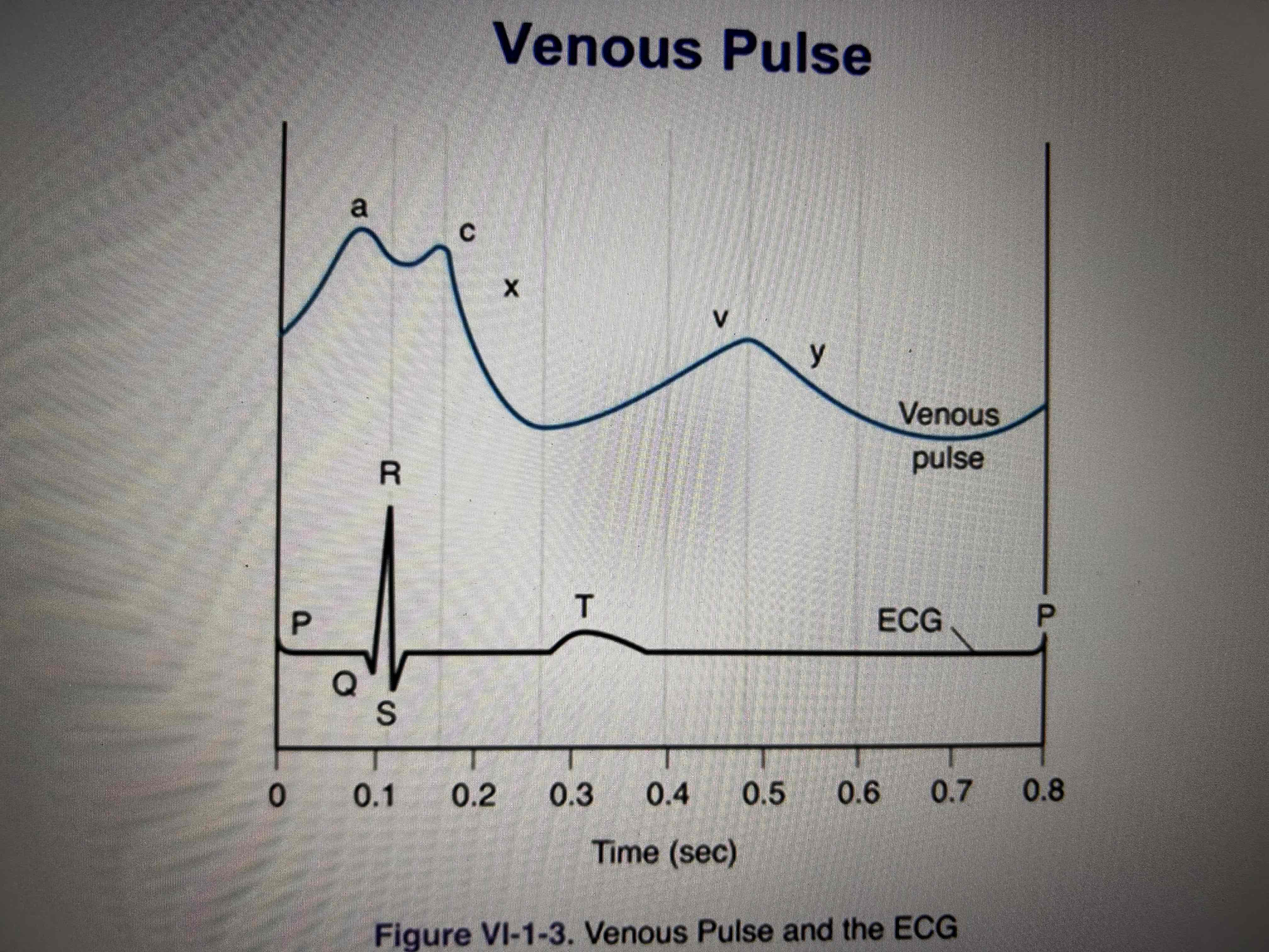 <p>a-atrial systole </p><p>c-bulging of the tricuspid valve </p><p>x-atrial diastole</p><p>v-venous return during systole of the ventricle </p><p>y-opening of the tricuspid valve </p>