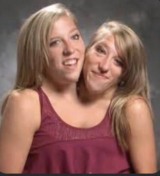 <p>Charlotte 1 and Charlotte 2!!</p>
