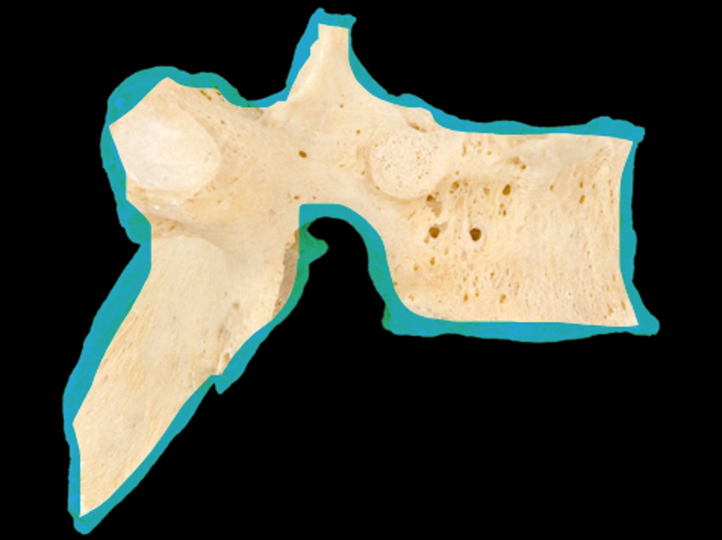 <p>name the individual vertebrae</p>