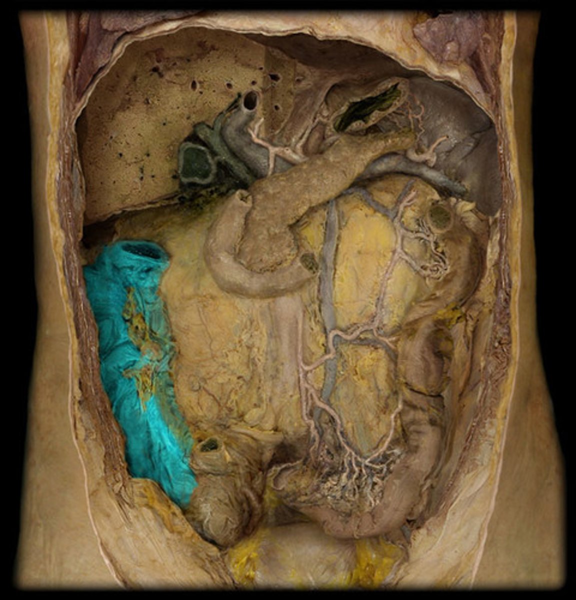 <p>What is this?</p>