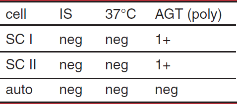 <p>possible interpretation of antibody screen </p>