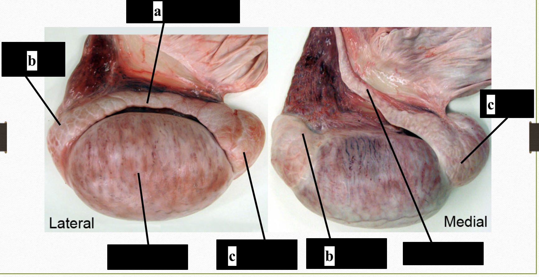 <p>a</p>