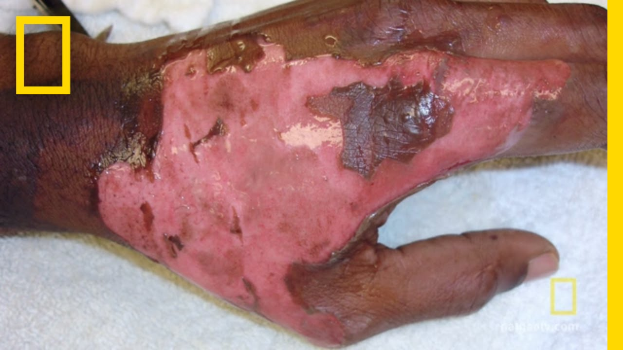 <p>What example of cell injury is this?</p>
