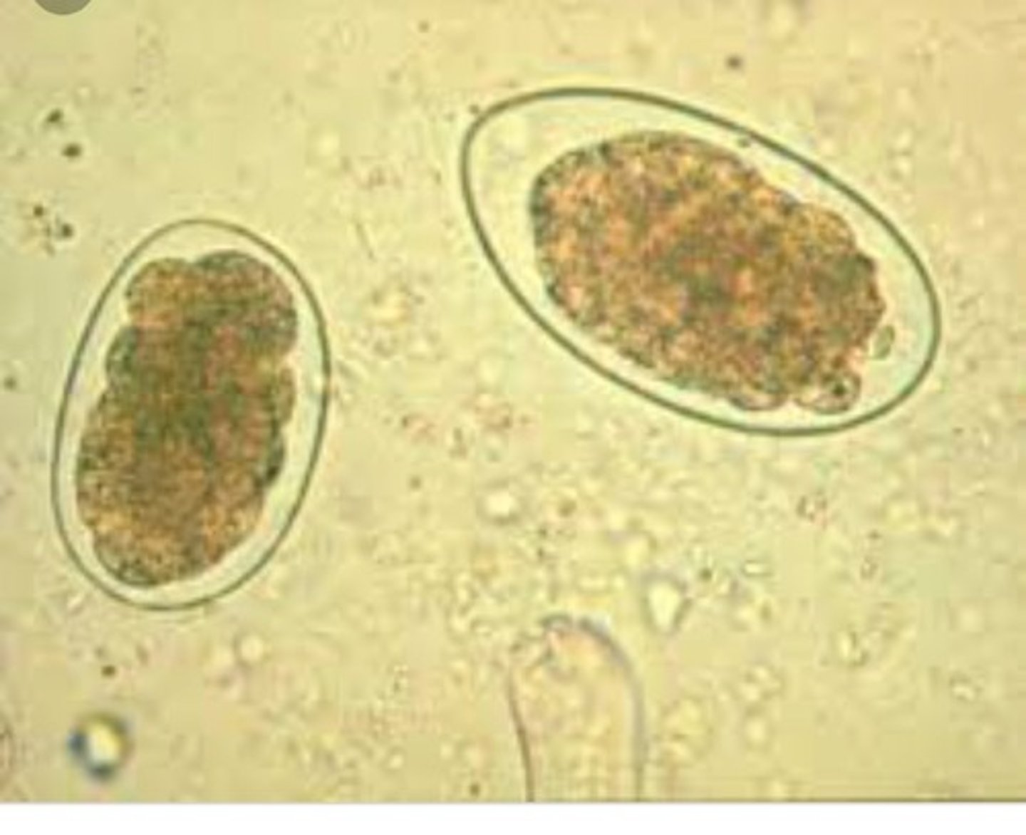 <p>Ancylostoma caninum</p>