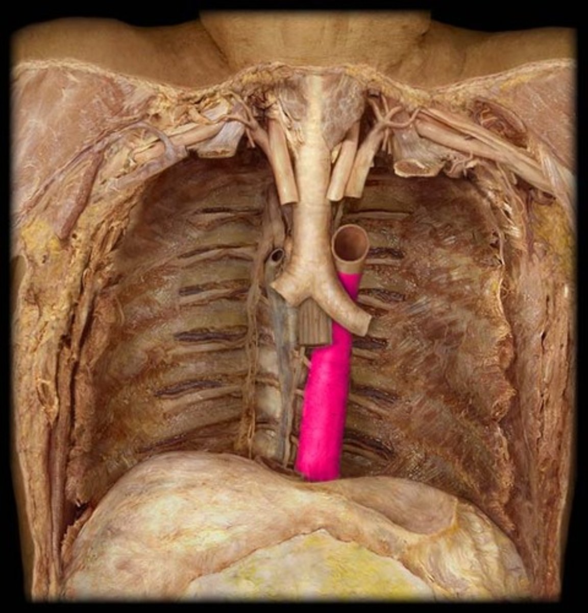 <p>identify this artery;</p><p>carries blood away from the heart down the midline of the body</p>