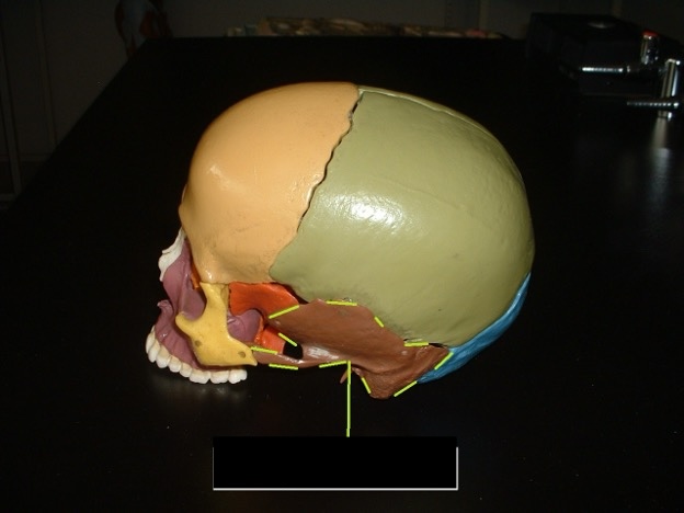 <p>The bones on the side of the head</p>
