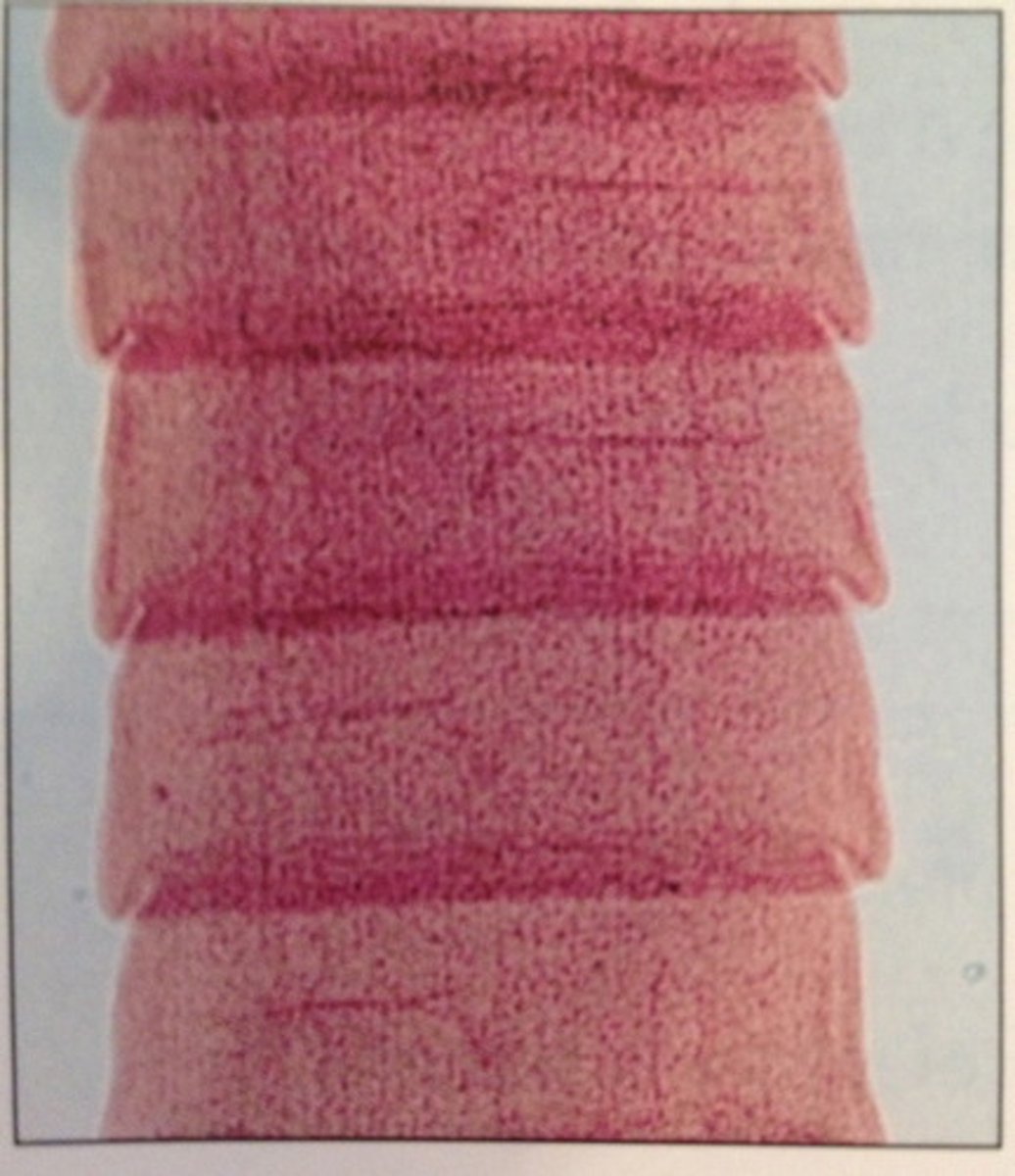 <p>Closest to head of tapeworm</p>