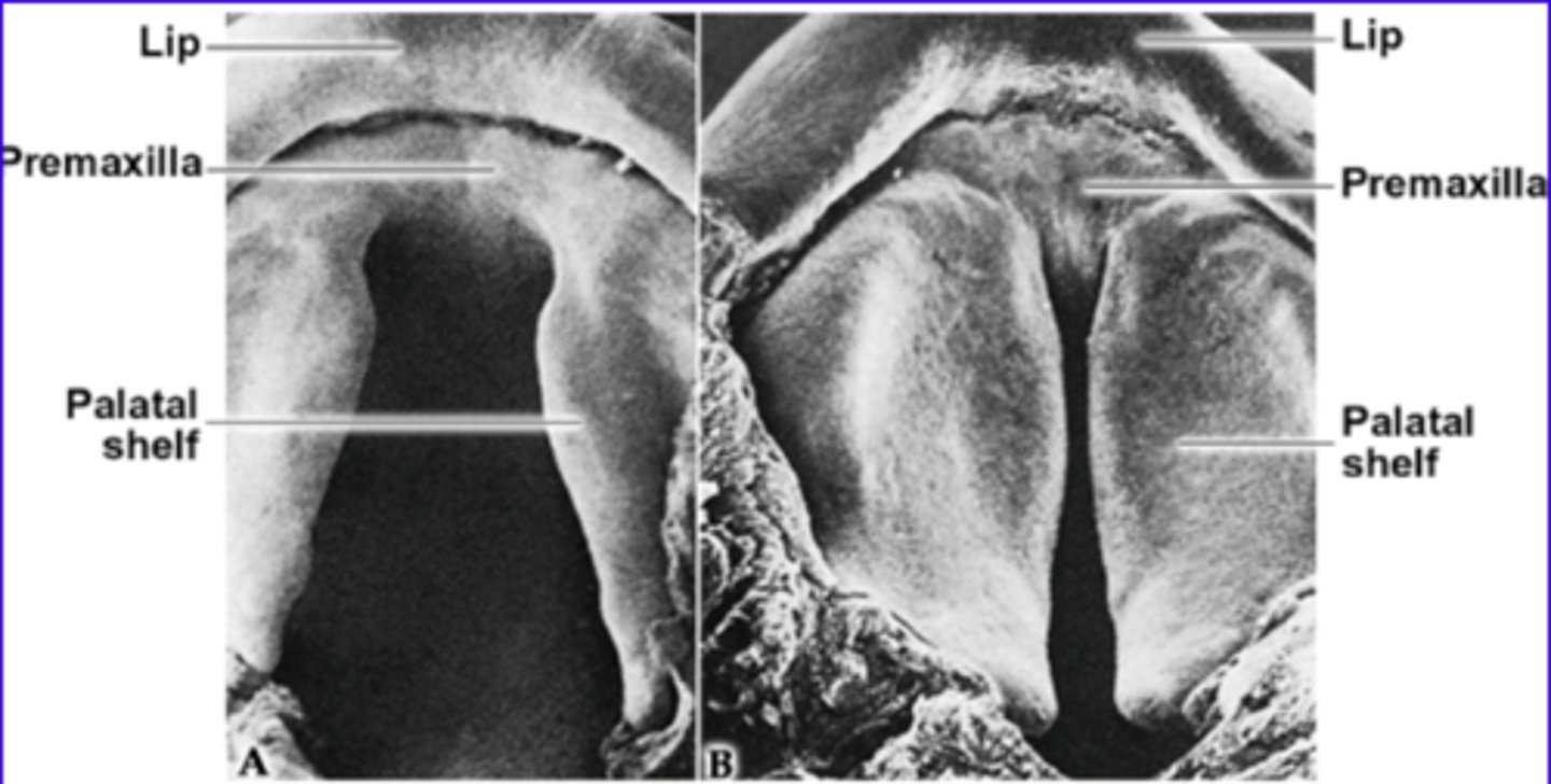 <p>When is the fusion of the palatal shelves compete? </p>
