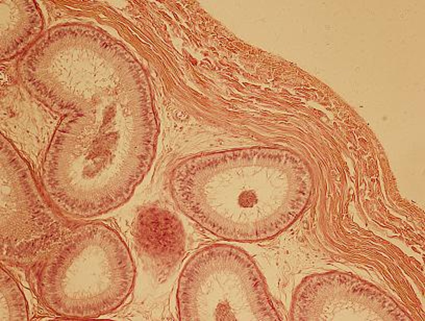 <p>epididymis</p>
