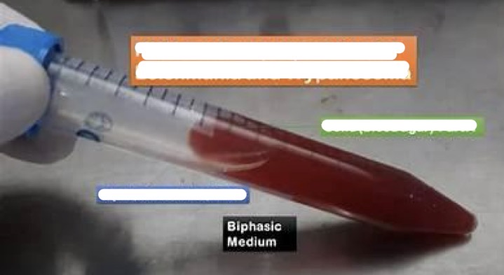 <p>A- what is the method of examination used here</p><p>B- what is the name of this medium</p><p>C- what is its components</p><p>D- what organism can found in this media</p><p>E- what is importance</p>