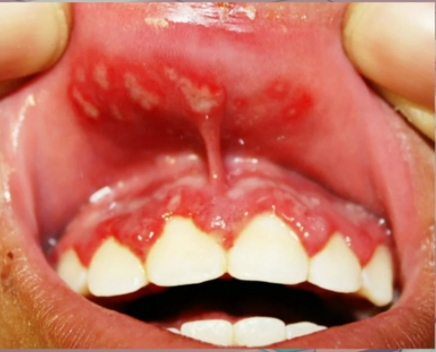 <p>diagnosis? </p>