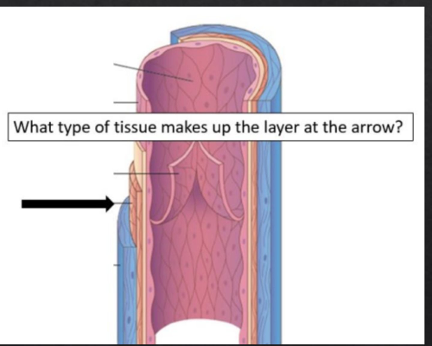 <p>What type of tissue makes up the layer at the arrow?</p>