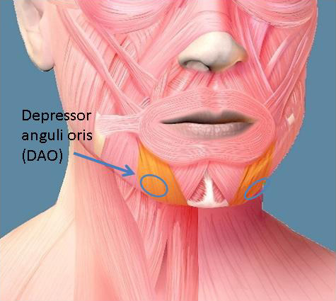 Depressor anguli oris
Origin:
Insertion:
Action: