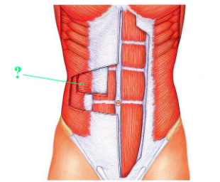 <p><span>identify the indicated muscle.</span></p>