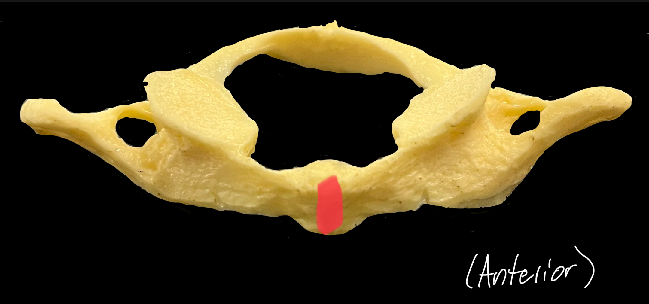 What is highlighted in red?

What originates here?